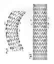 Fig. 05 - Bend-capable stent prosthesis