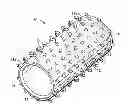 Fig. 01 - Vascular prosthesis