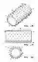 Fig. 06 - Vascular prosthesis