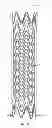 Fig. 04 - ELECTROSPUN PTFE COATED STENT AND METHOD OF USE