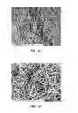 Fig. 08 - ELECTROSPUN PTFE COATED STENT AND METHOD OF USE