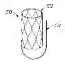Fig. 01 - Heart Valve Sealing Devices