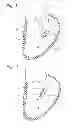 Fig. 02 - Heart Valve Sealing Devices