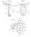 Fig. 04 - Heart Valve Sealing Devices