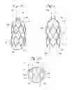 Fig. 07 - Heart Valve Sealing Devices