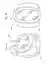 Fig. 23 - Heart Valve Sealing Devices