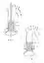Fig. 06 - Integrated Dilation Balloon and Valve Prosthesis Delivery System
