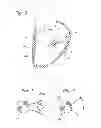 Fig. 03 - Heart valve sealing devices