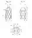 Fig. 07 - Heart valve sealing devices