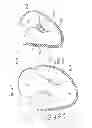 Fig. 16 - Heart valve sealing devices