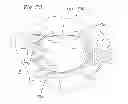 Fig. 20 - Heart valve sealing devices