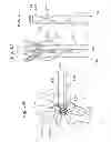 Fig. 24 - Heart valve sealing devices
