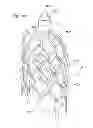 Fig. 27 - Heart valve sealing devices