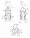 Fig. 07 - Heart valve sealing devices