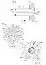 Fig. 08 - Adjustment assembly for an adjustable prosthetic valve device