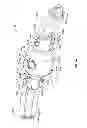 Fig. 09 - Adjustment assembly for an adjustable prosthetic valve device