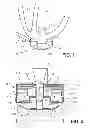 Fig. 02 - Hall sensor mounting in an implantable blood pump