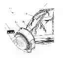 Fig. 01 - Ventricular cuff