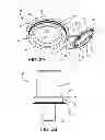 Fig. 03 - Ventricular cuff