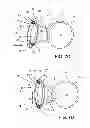 Fig. 09 - Ventricular cuff