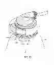 Fig. 43 - Ventricular cuff