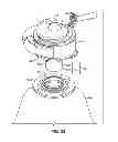 Fig. 44 - Ventricular cuff
