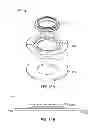 Fig. 45 - Ventricular cuff