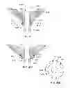 Fig. 53 - Ventricular cuff