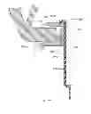 Fig. 55 - Ventricular cuff
