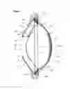 Fig. 06 - Inflatable intra ocular lens/lens retainer