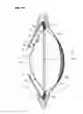 Fig. 07 - Inflatable intra ocular lens/lens retainer