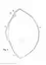 Fig. 09 - Inflatable intra ocular lens/lens retainer