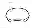 Fig. 12 - Inflatable intra ocular lens/lens retainer