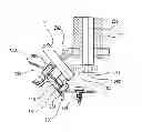 Fig. 01 - Laminoplasty implant, method and instrumentation