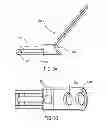 Fig. 05 - Laminoplasty implant, method and instrumentation