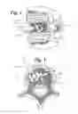 Fig. 04 - Expandable porous mesh bag device and methods of use for reduction, filling, fixation and supporting of bone