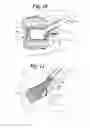 Fig. 07 - Expandable porous mesh bag device and methods of use for reduction, filling, fixation and supporting of bone