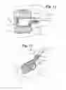 Fig. 08 - Expandable porous mesh bag device and methods of use for reduction, filling, fixation and supporting of bone