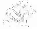 Fig. 01 - Artificial cervical and lumbar discs, disc plate insertion gun for performing sequential single plate intervertebral implantation enabling symmetric bi-disc plate alignment for interplate mobile core placement