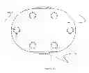 Fig. 05 - Artificial cervical and lumbar discs, disc plate insertion gun for performing sequential single plate intervertebral implantation enabling symmetric bi-disc plate alignment for interplate mobile core placement