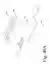 Fig. 33 - DEVICES AND METHODS FOR INTER-VERTEBRAL ORTHOPEDIC DEVICE PLACEMENT