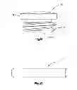 Fig. 09 - Adjustable intervertebral implant