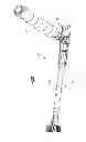 Fig. 10 - Adjustable intervertebral implant