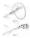 Fig. 04 - Memory material implant system and methods of use