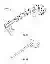 Fig. 06 - Memory material implant system and methods of use