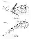 Fig. 07 - Memory material implant system and methods of use
