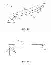 Fig. 10 - Memory material implant system and methods of use