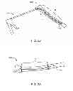 Fig. 12 - Memory material implant system and methods of use