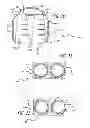 Fig. 06 - Spinal implant having deployable bone engaging projections