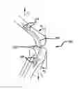 Fig. 01 - Extra-articular implantable mechanical energy absorbing systems
